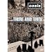 �[�A�E�A���h�E�[�� [DVD]