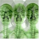 Supergrass