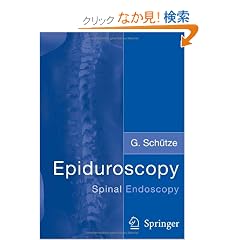 Epiduroscopy: Spinal Endoscopy
