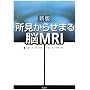 �������点�܂�]MRI �V��