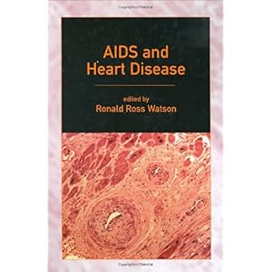 【クリックで詳細表示】AIDS and Heart Disease (No Series) [ハードカバー]