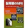 �]�Ґ���MRI ��2��